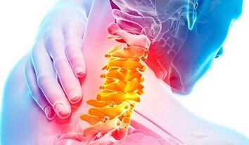 Príznaky osteochondrózy krčnej chrbtice