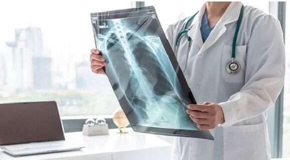 Röntgenová diagnostika bolesti pod ľavou lopatkou