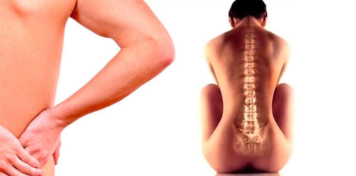bolesť v dolnej časti chrbta v dôsledku osteochondrózy