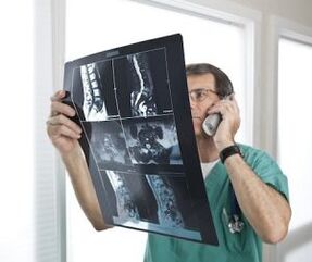 Myelografia na diagnostiku osteochondrózy a intervertebrálnych hernií