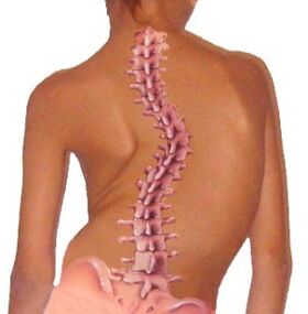 Zakrivenie chrbtice vedie k osteochondróze
