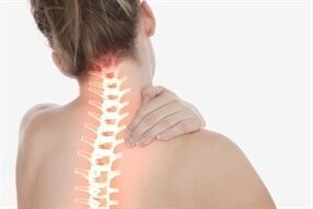 Cervikálna osteochondróza u žien